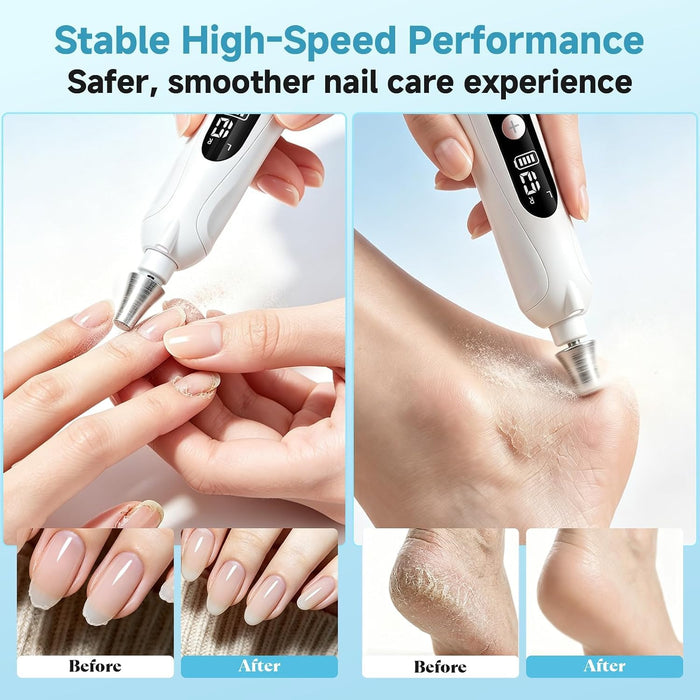 Electric Nail File, Cordless Toe Nail Grinder for Thick Toenails & Callus, Rechargeable Nail Drill for Manicure and Pedicure with LCD & Lamp, Gifts for Women Men Seniors