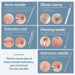 Blackhead Remover Comedone Extractor Acne Removal Kit..