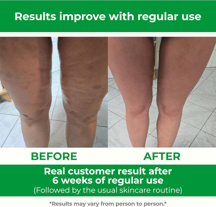 Cellulite Manual Massager Roller for Thighs and Buttocks