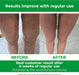 Cellulite Manual Massager Roller for Thighs and Buttocks