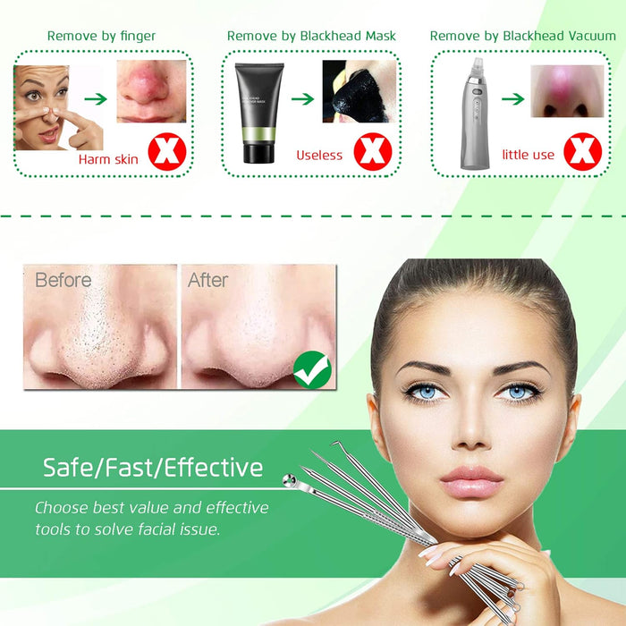 5PCS Blackhead Remover Comedone Extractor, Curved Blackhead Tweezers Kit, Professional Stainless Pimple Acne Blemish Rem