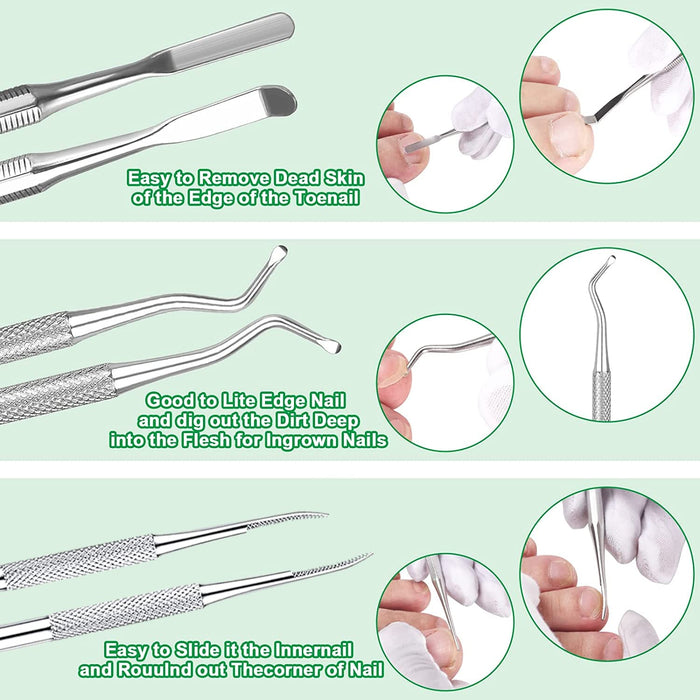 6-Pack Ingrown Toenail File and Lifters, Professional Surgical Stainless Steel Ingrown Toenail Removal Tool Kit, Manicur
