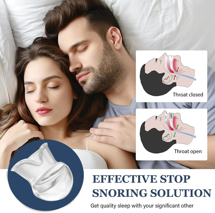 Tongue Stabilizing Device Mouthpiece - Anti-Snore Device, Reusable Snore Solution Stopper for Men/Women - AS01