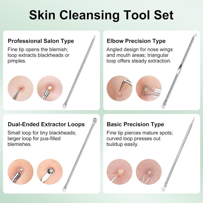 Blackhead Remover Tools for Face, Black Head Remover for Nose, 304 Stainless Steel Pore Extractor Spatula for Deep Pore 