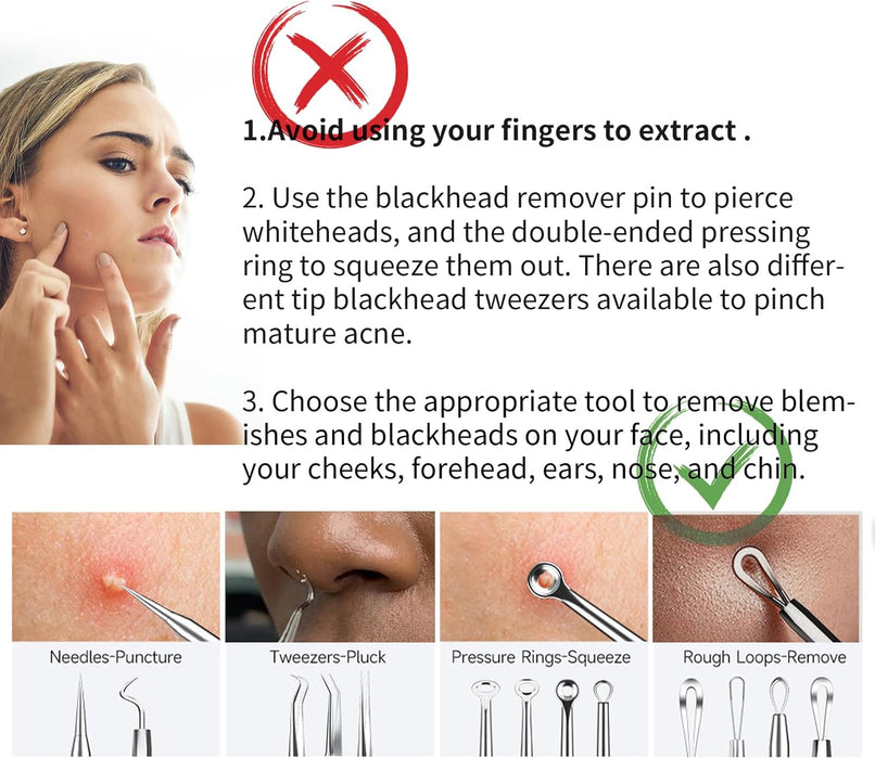 Pimple Popper Tool, Blackhead Remover Acne and Zit Comedone Extractor Kit