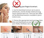Pimple Popper Tool, Blackhead Remover Acne and Zit Comedone Extractor Kit