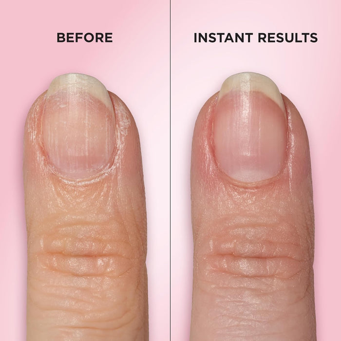 Push & Buff 2-in-1 Cuticle Care Treatment Pen | Exfoliates, Polishes and Smooths Cuticles | Textured Tip for Instant Results | Easy, Mess-Free Nail Care on the Go