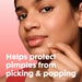 Hero Cosmetics Original Nighttime Acne Pimple Patches, 36 Ct