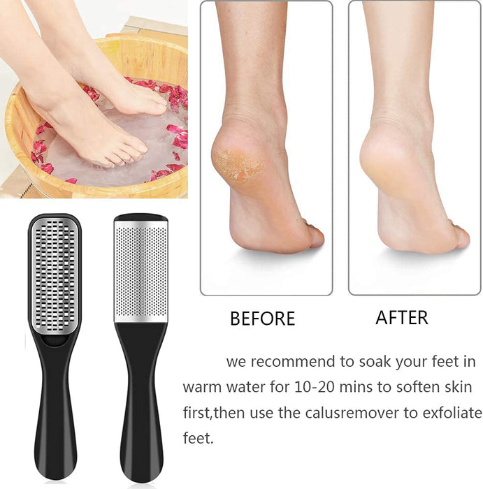 36 in 1 Professional Pedicure Kit, Foot File, Foot Rasp and Callus Remover