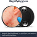 Pimple Popper Tool, Blackhead Remover Acne and Zit Comedone Extractor Kit