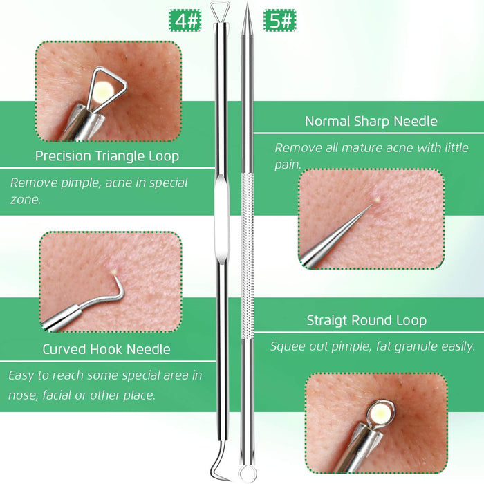 5PCS Blackhead Remover Comedone Extractor, Curved Blackhead Tweezers Kit, Professional Stainless Pimple Acne Blemish Rem