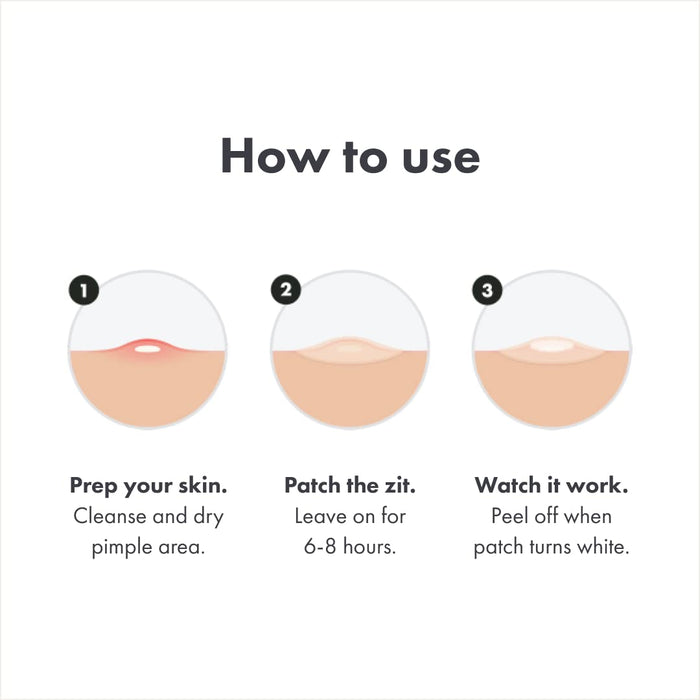 Original from Hero Cosmetics - Hydrocolloid Acne Pimple Patch for Covering Zits and Blemishes, Spot Stickers for Face and Skin, Vegan-Friendly and Not Tested on Animals (36 Count)