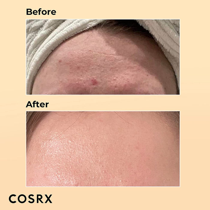 COSRX Snail Mucin 96% Power Repairing Essence 3.38 Fl.Oz, 100Ml, Hydrating Serum for Face with Snail Secretion Filtrate for Dark Spots and Fine Lines, Not Tested on Animals, No Parabens, No Sulfates, No Phthalates, Korean Skincare